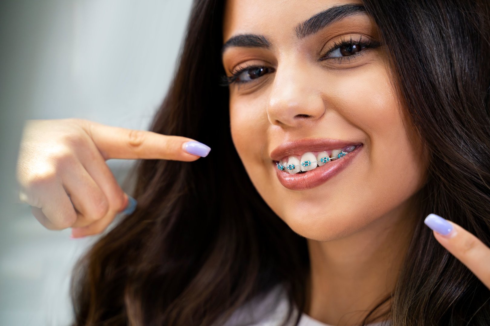 Ortodoncia (Brackets)