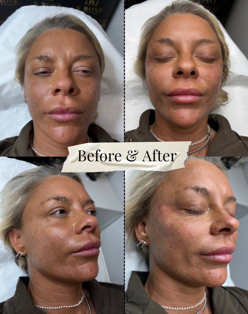 Lily Dot Aesthetics Work