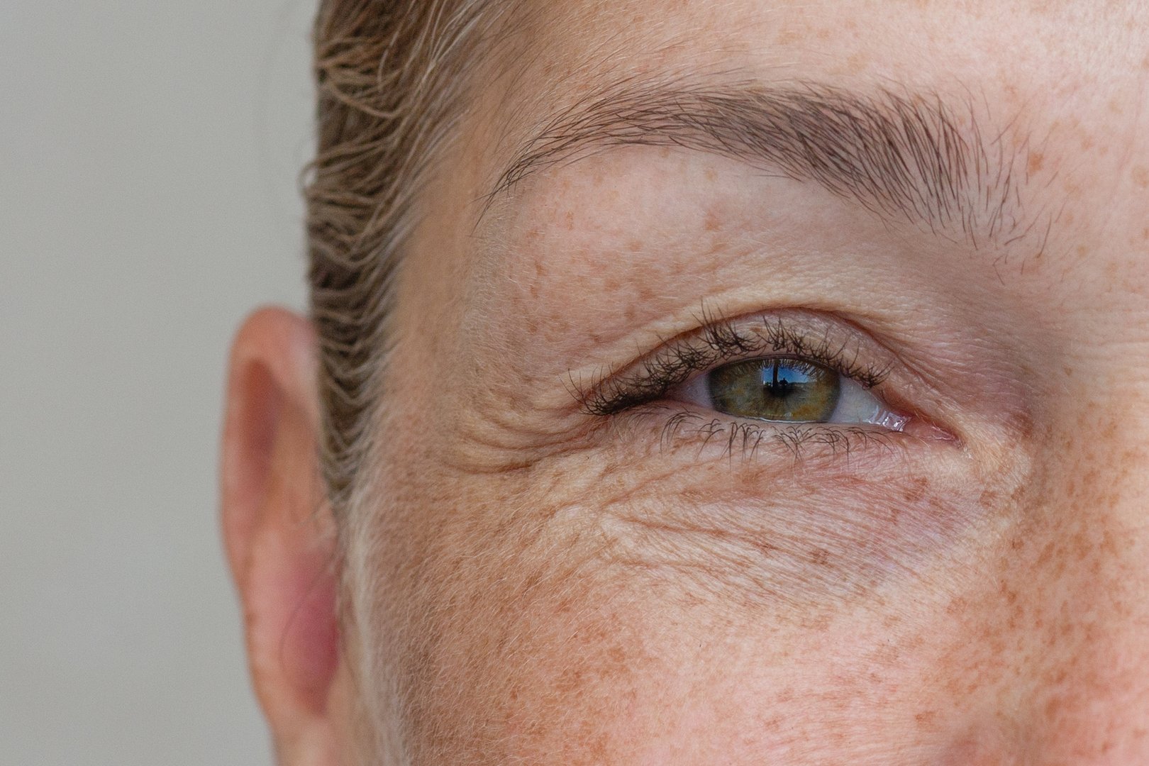 Close-up of middle-aged woman showing upper eyelid fold
