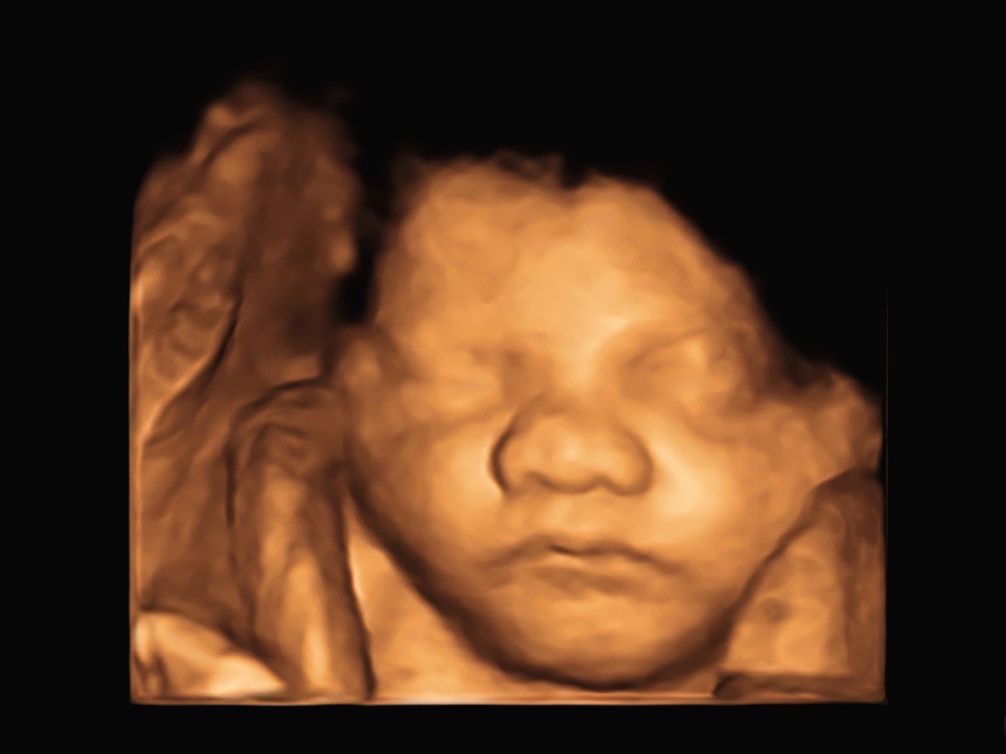 image Ultrasound 3D 4D of baby in mother's womb.