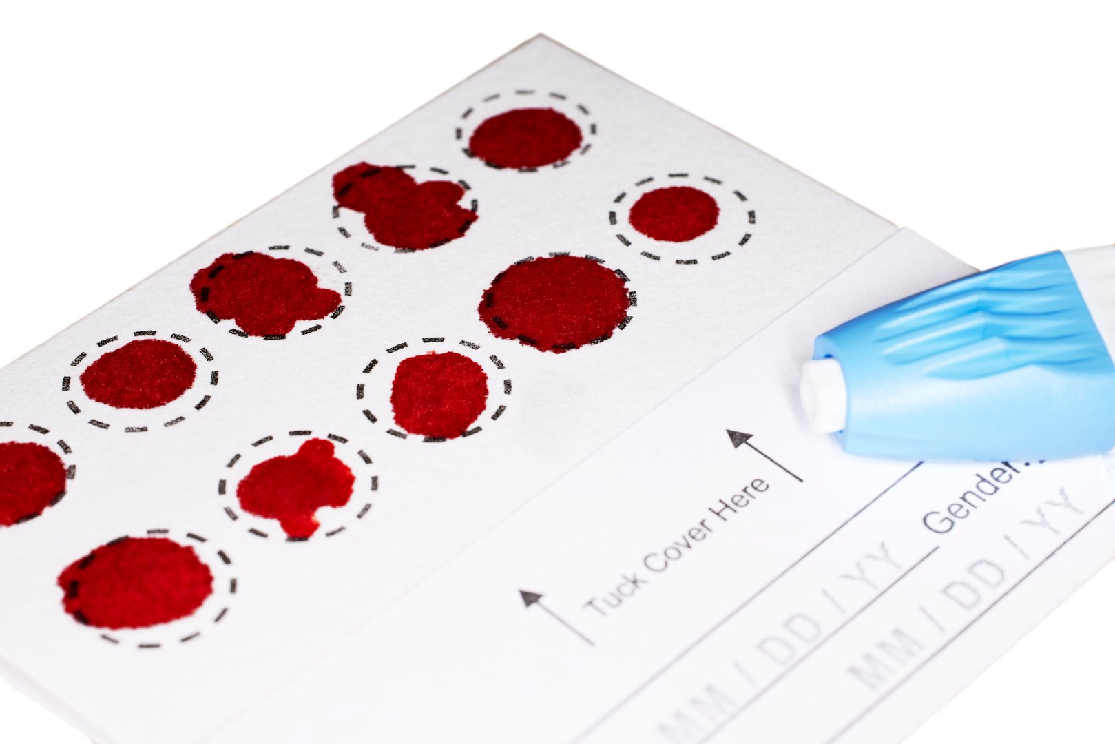A Completed Blood Spot test card with droplets of blood for hormone testing