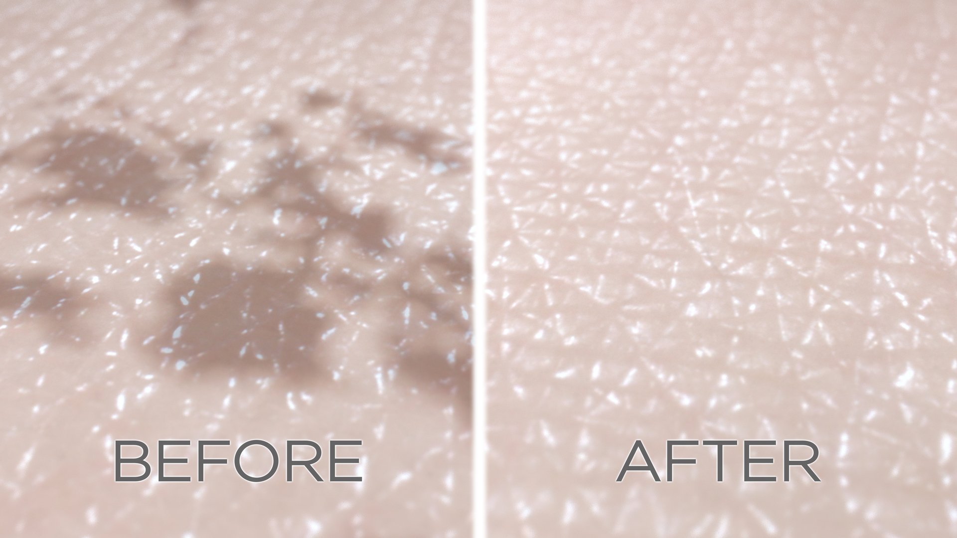 3D-rendered illustration showing reduced pigmentation and fading of dark spots. Visual results from procedures like laser therapy, microneedling, chemical peels, or topical creams containing ingredients such as Tranexamic acid, Niacinamide, Rucinol, Cysteamine, and Tretinoin