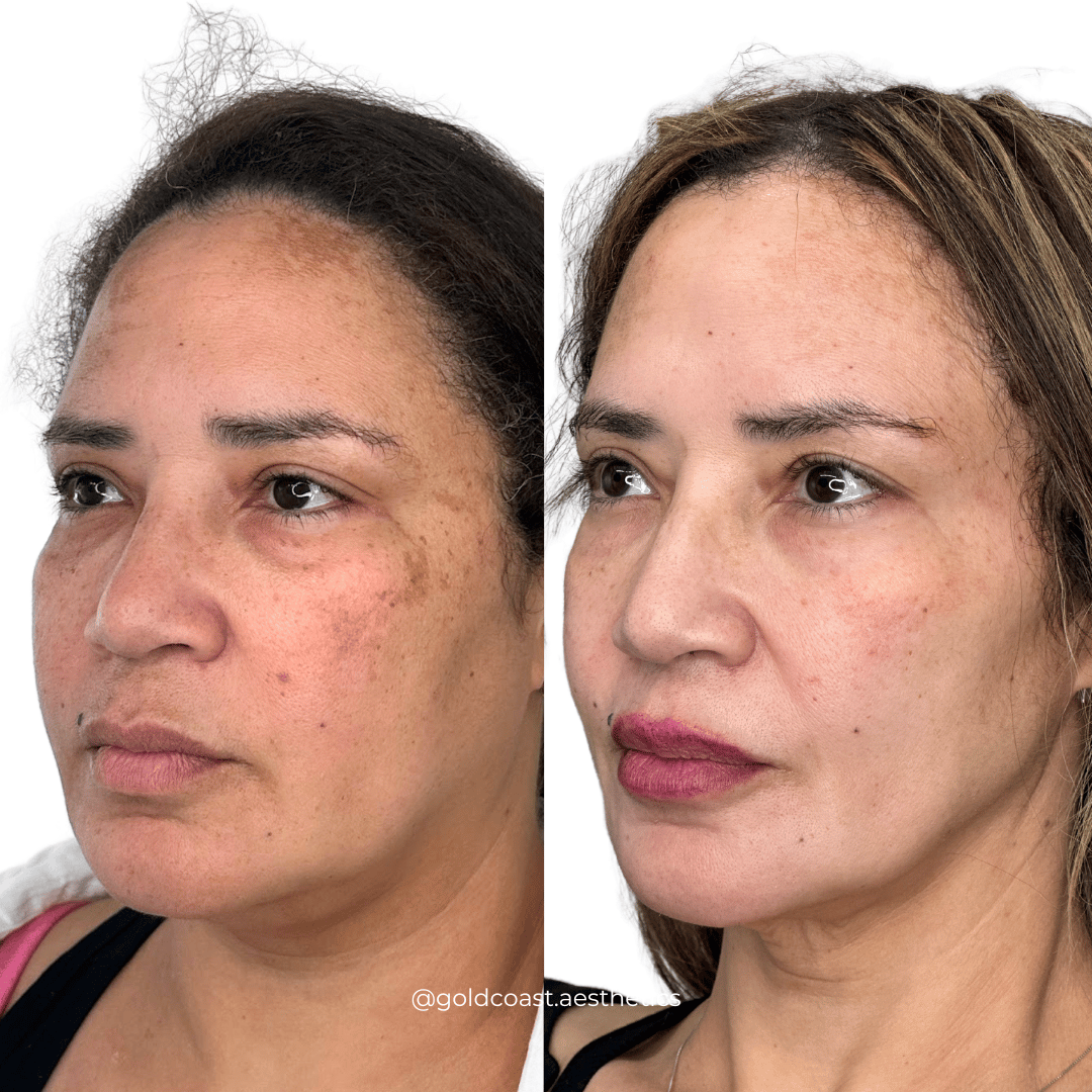 Aesthetic facial transformation