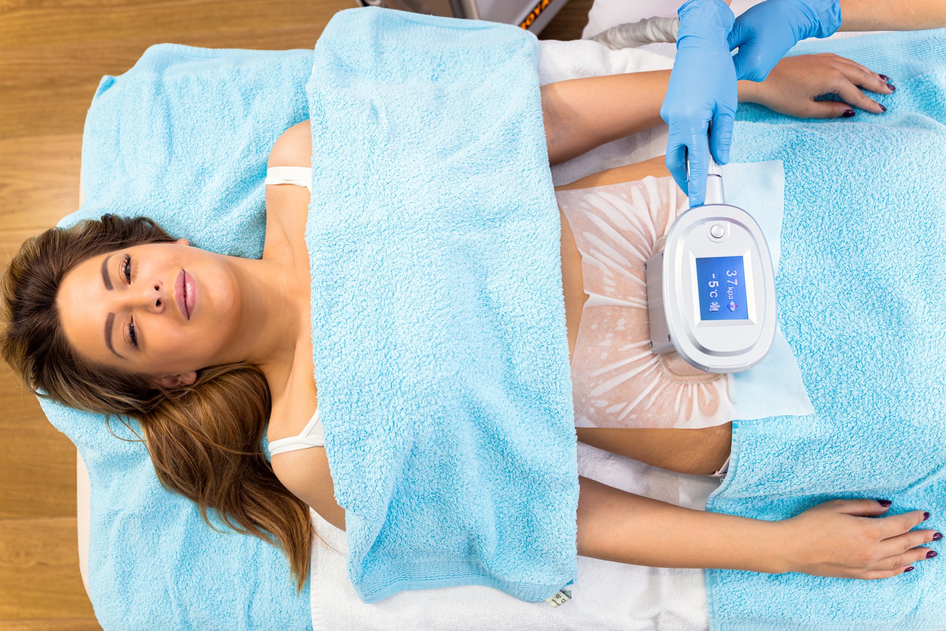 Cryolipolyse Zadel Vet Behandeling voor Vrouwen