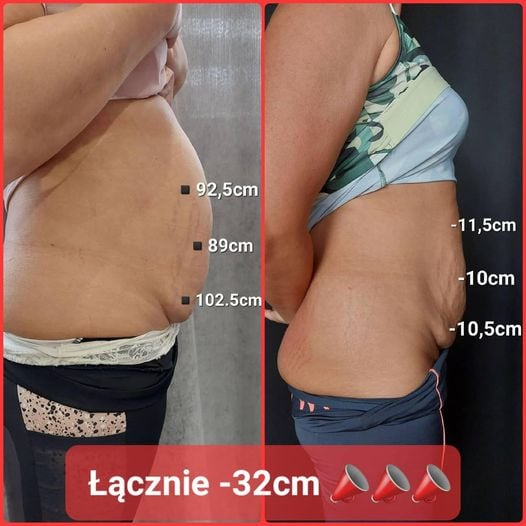 Efekt ujędrniania sylwetki - przed i po