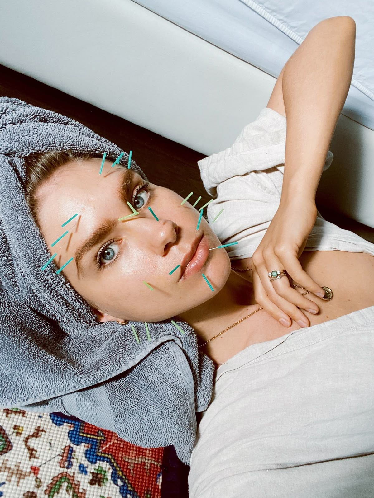 Diana Badea - Acupunctura Facială