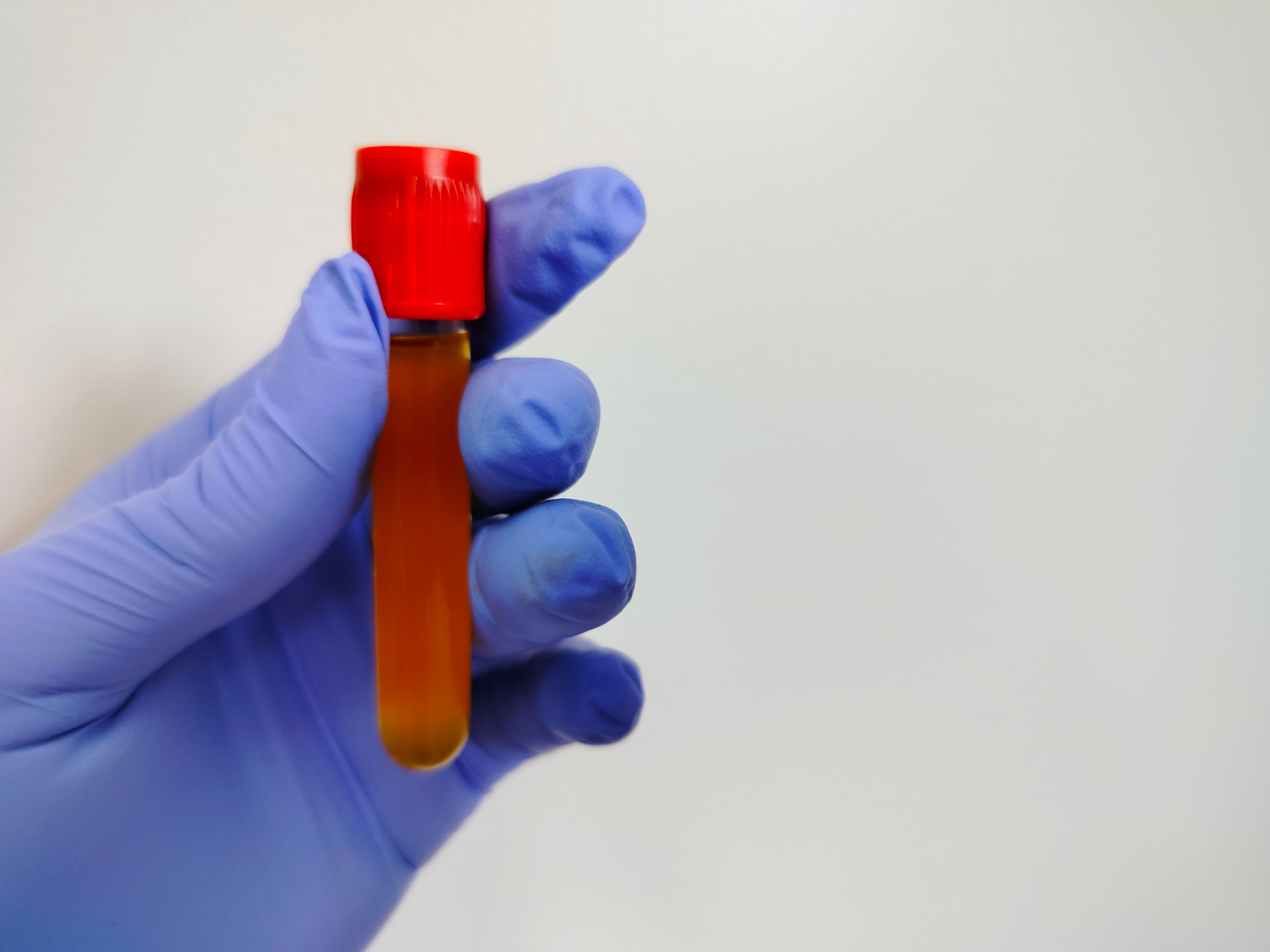 medical officer holding blood sample in vacuum tube