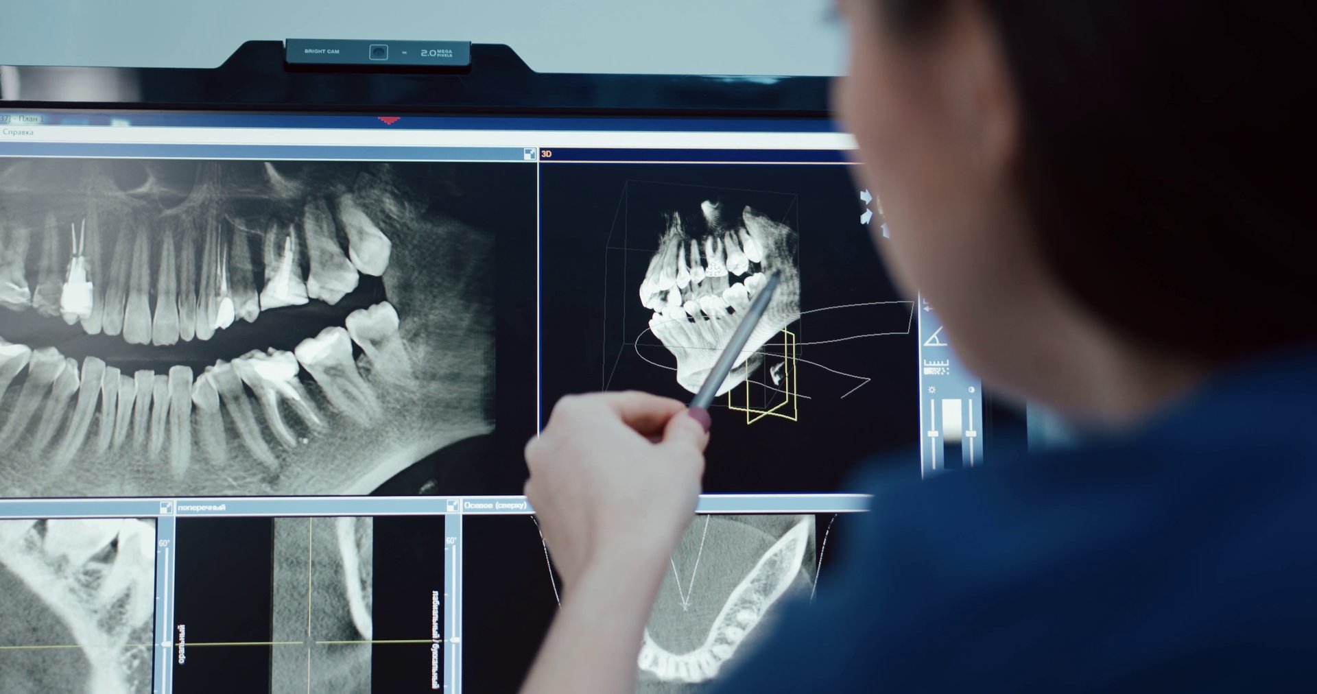 Dental X-ray imaging for accurate diagnosis
