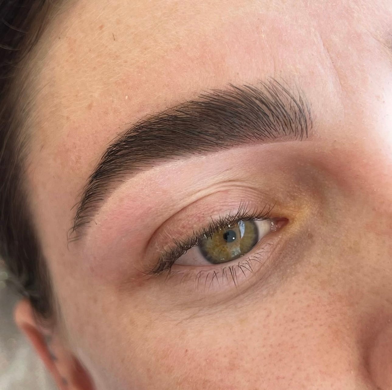 Bonnie Aesthetics client transformation