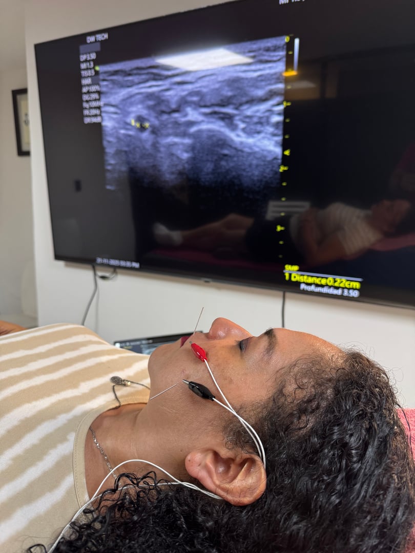 Sesión clínica de ecografía intervencionista guiada para tratamiento facial en R4 Fisioterapia Regenerativa