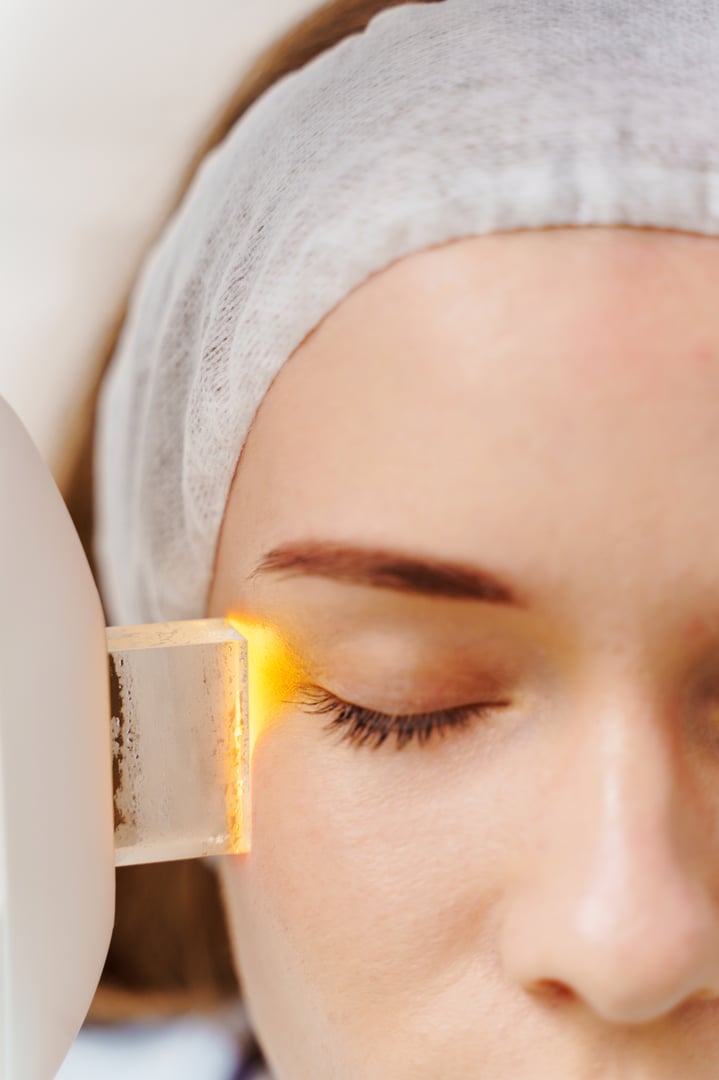 IPL face pigmentation therapy by beautician. Ultrasound laser facial pigmentation treatment in medicine center. Care after skin pigmentation procedure