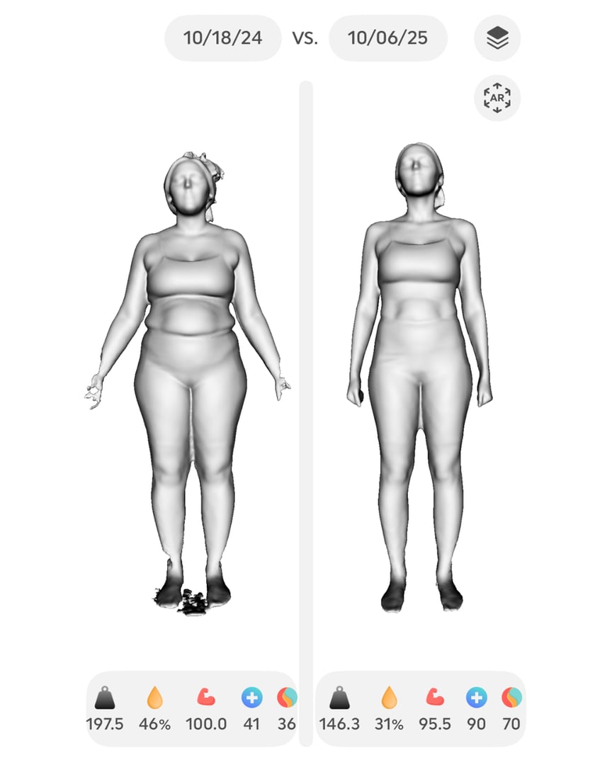 Tirzepatide weight loss transformation