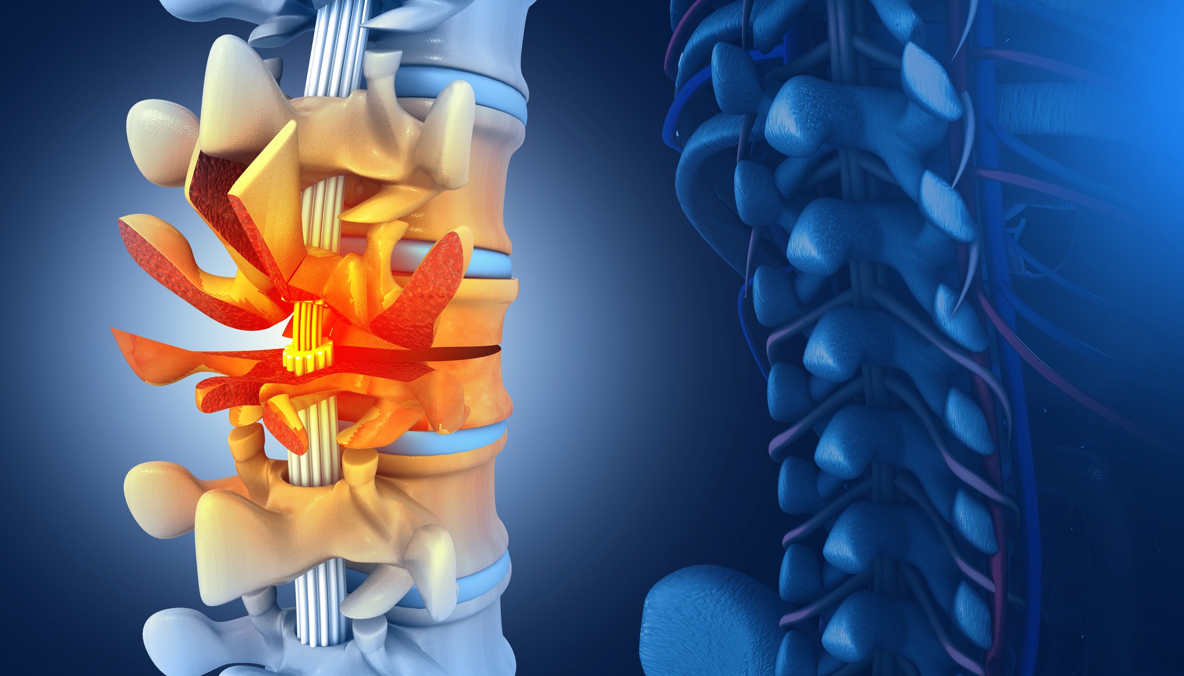 Human spinal cord injury pinched nerve