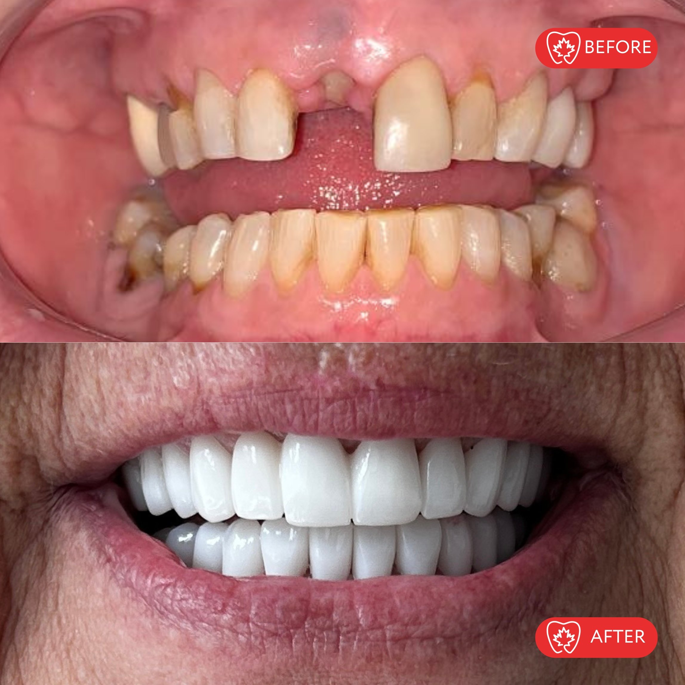 Después del tratamiento