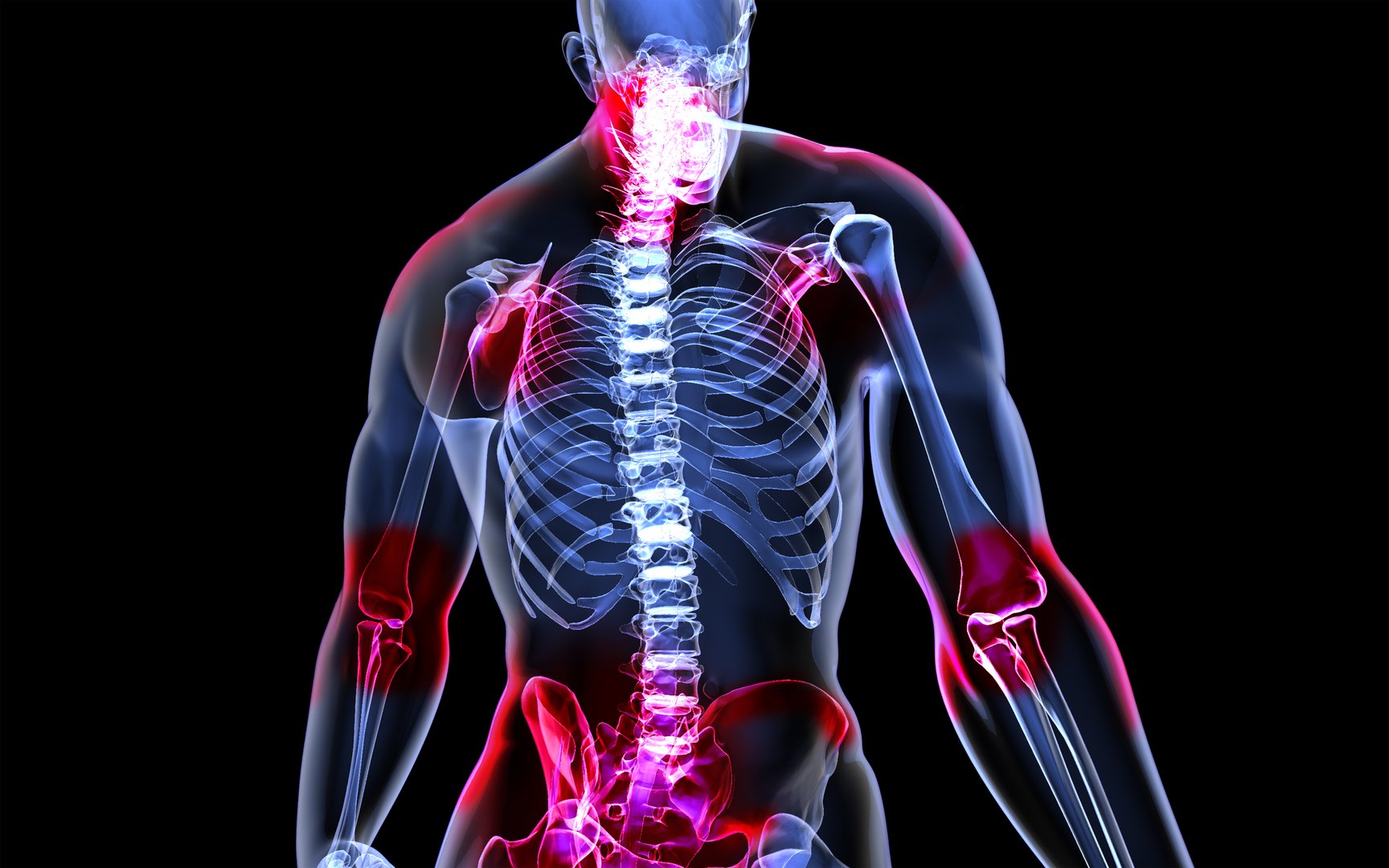 Poor posture skeleton illustration