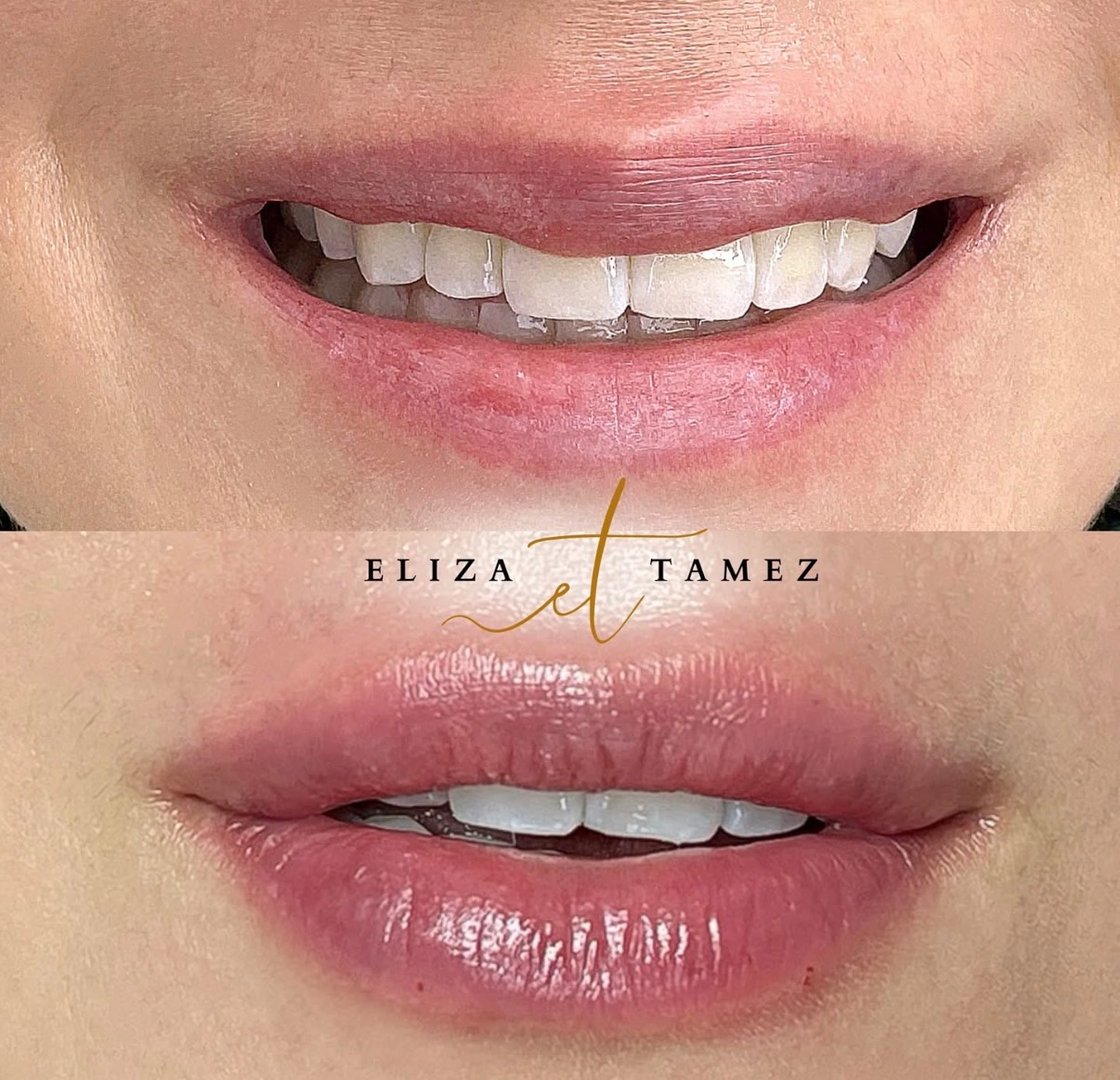 Micropigmentación de labios