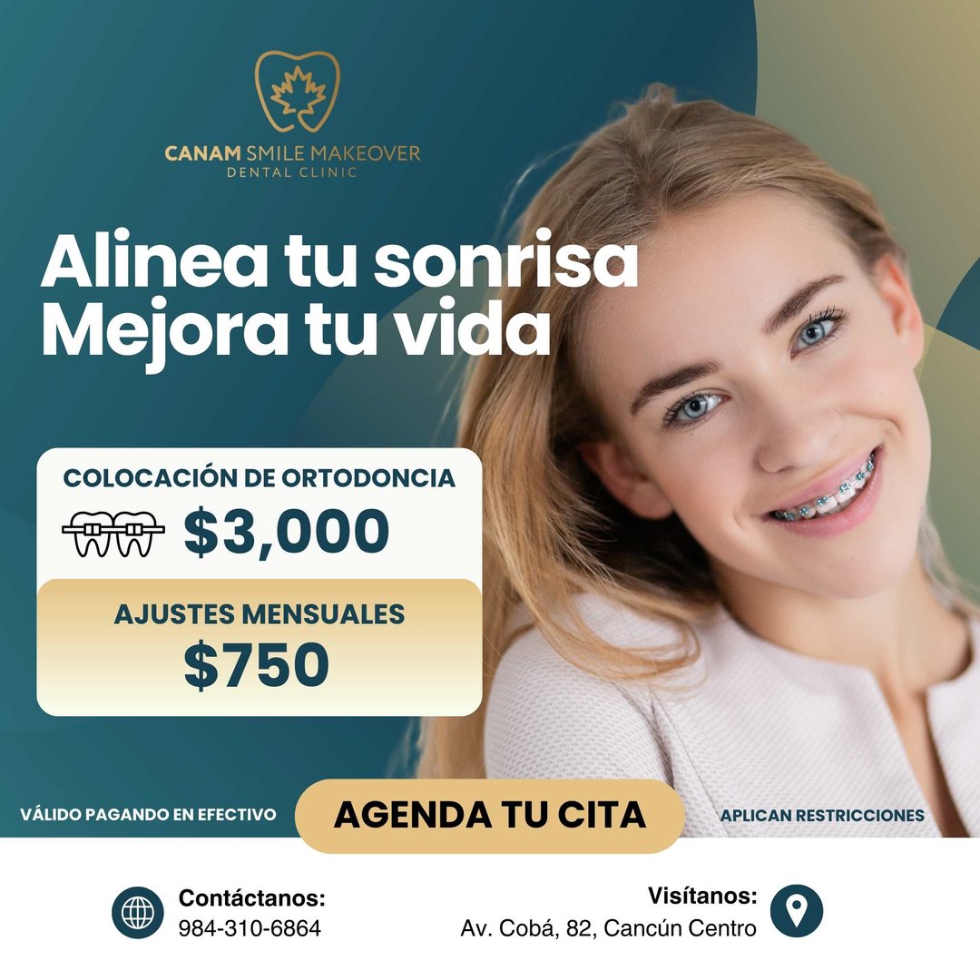 Promoción dental Canam Smile Makeover