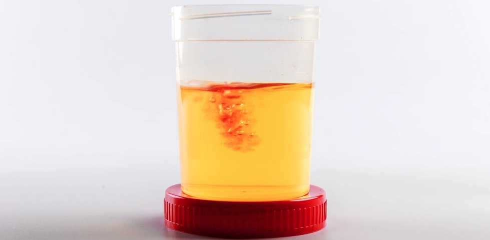 Hình ảnh minh họa các dấu hiệu cảnh báo