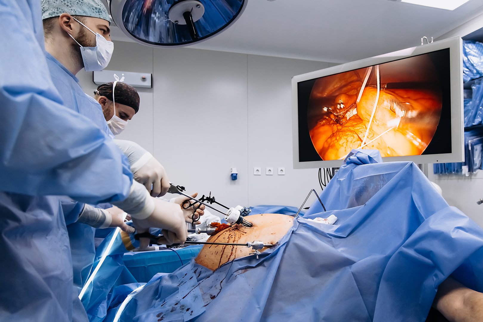 Experienced surgeons in medical gowns, caps, masks and gloves perform an operation in a modern clinic. Group of professional doctors using modern medical equipment in operating room.
