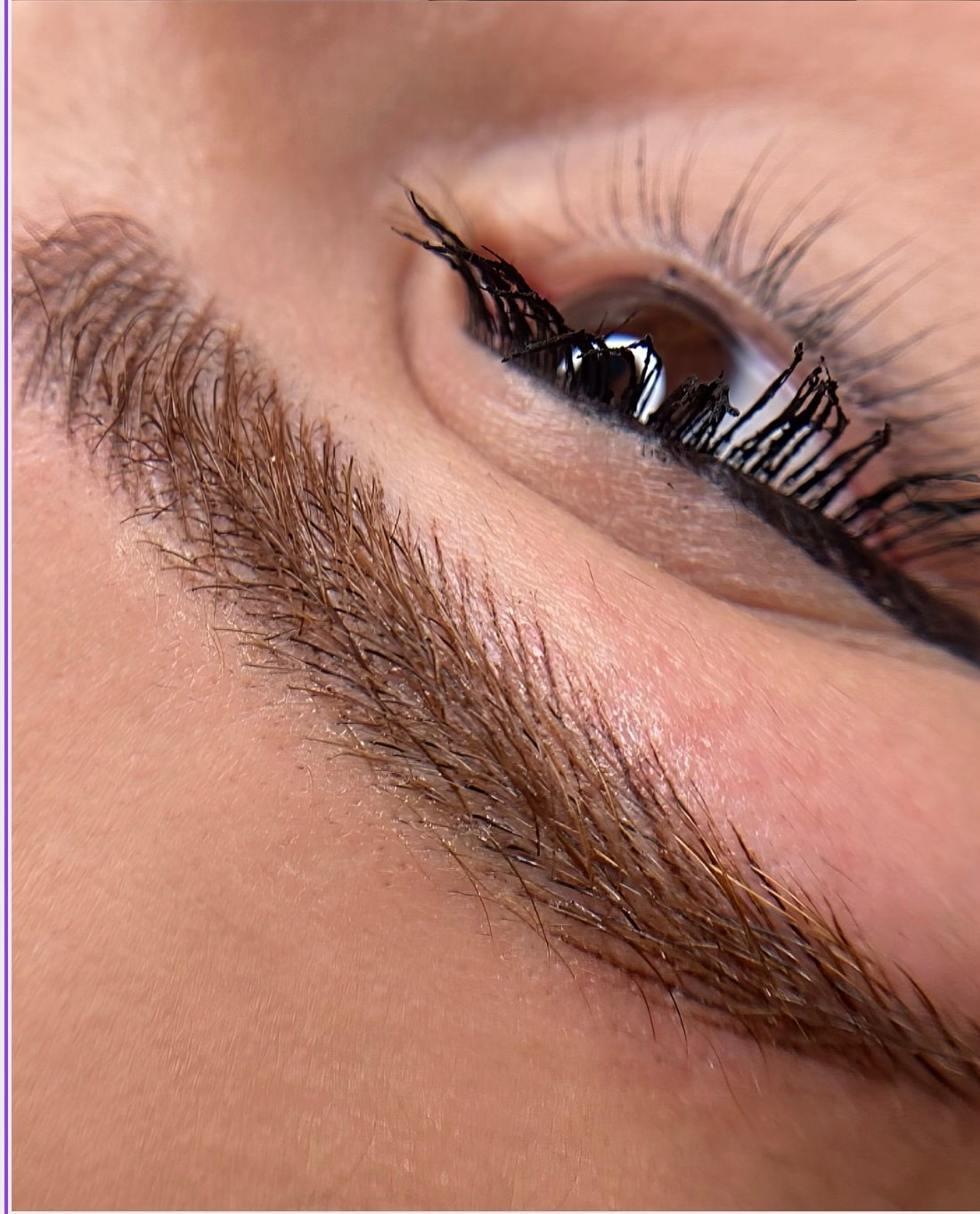 Brow transformation before and after