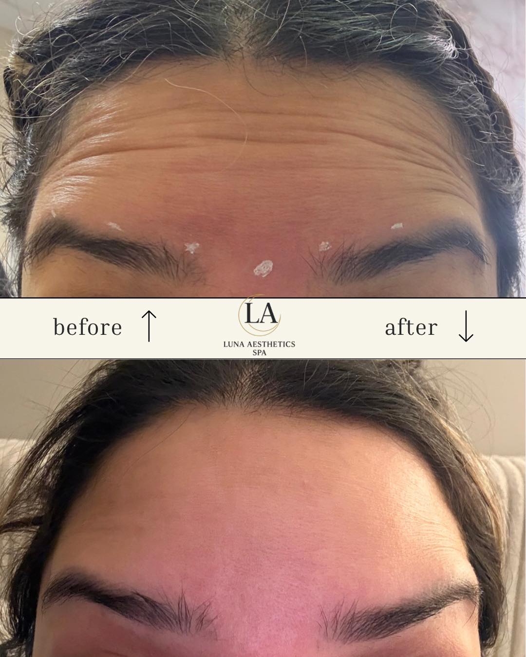 Treatment results