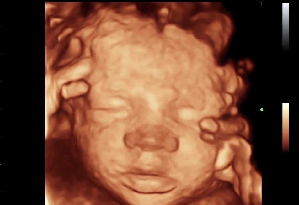 ultrasound of baby in pregnant woman