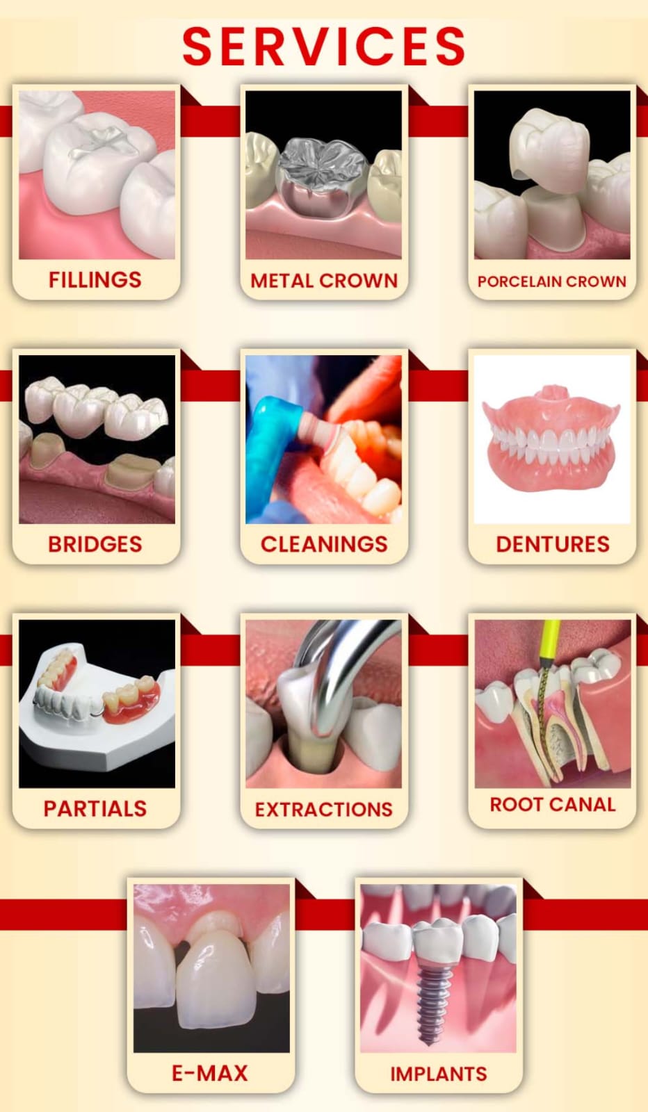 Dental services and treatments