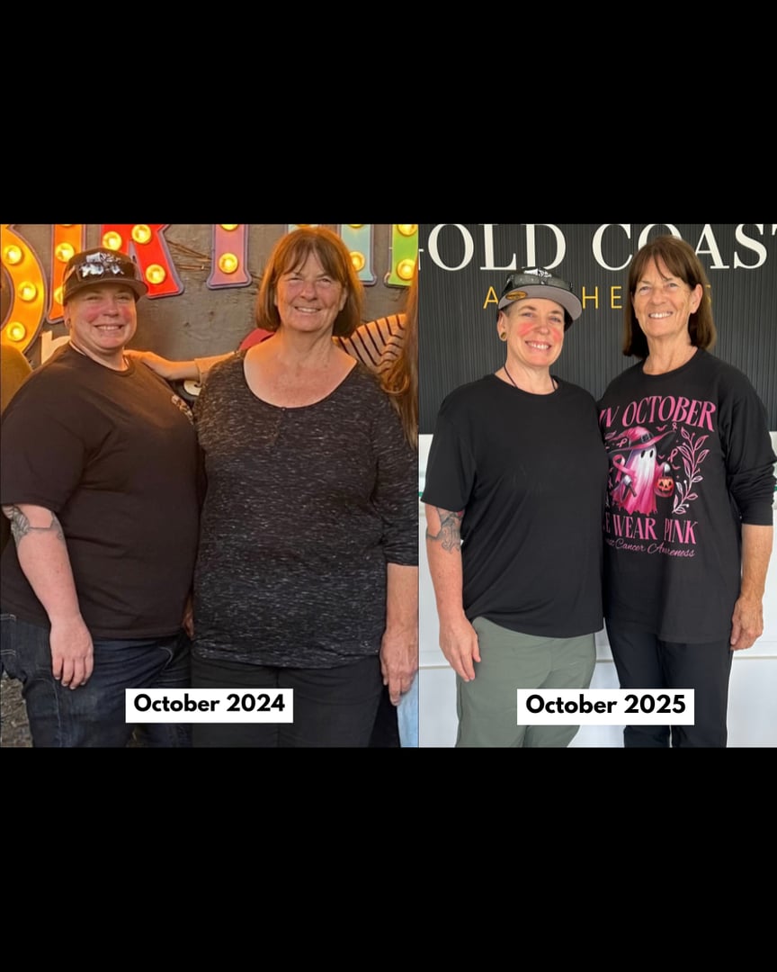 Tirzepatide weight loss transformation