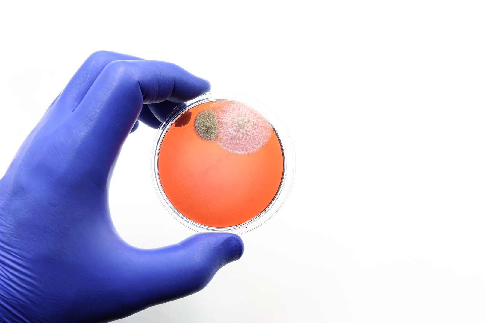 Petri dish with two colonies of fungi. Research in Microbiology. Pathogens.