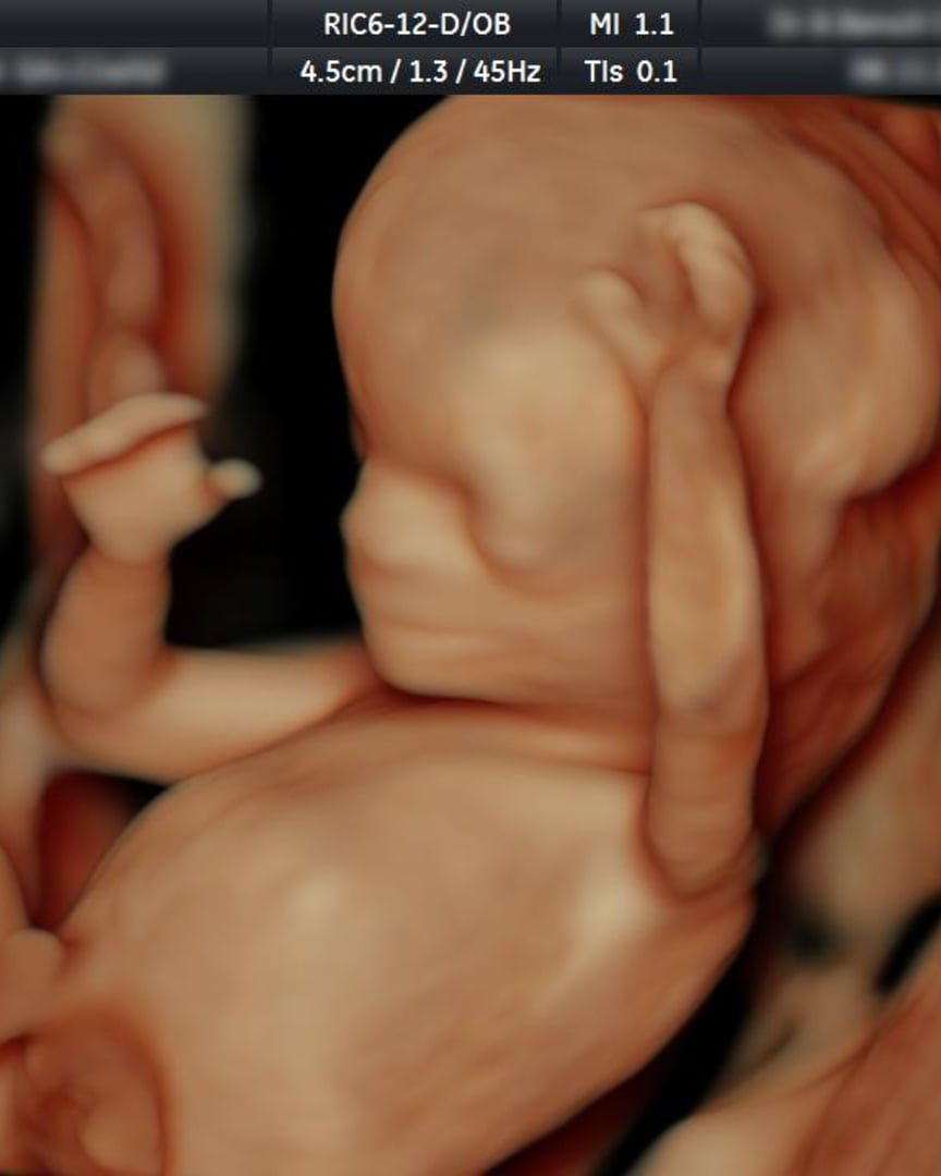 Control Prenatal Holístico