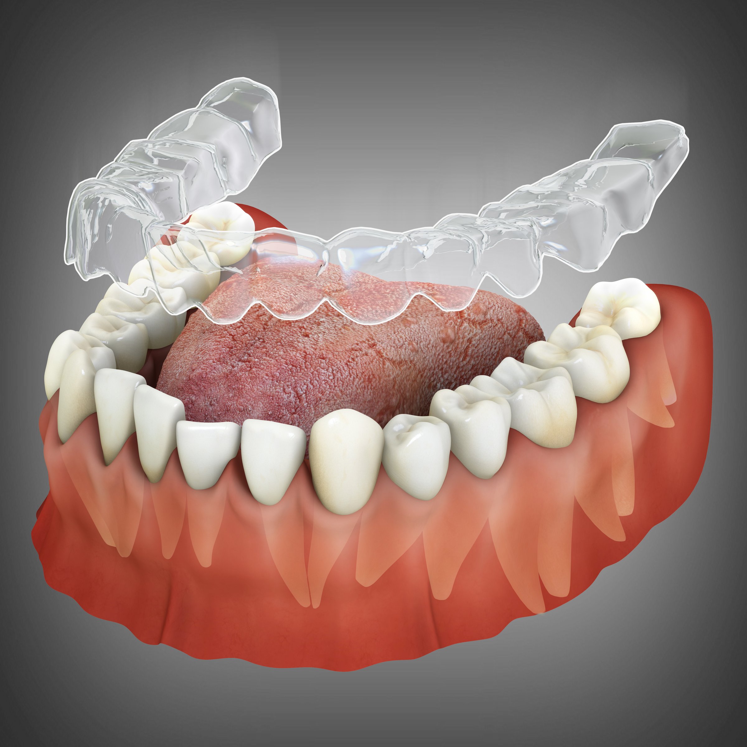 Invisalign braces or invisible retainer. Medically approved dental 3D illustration
