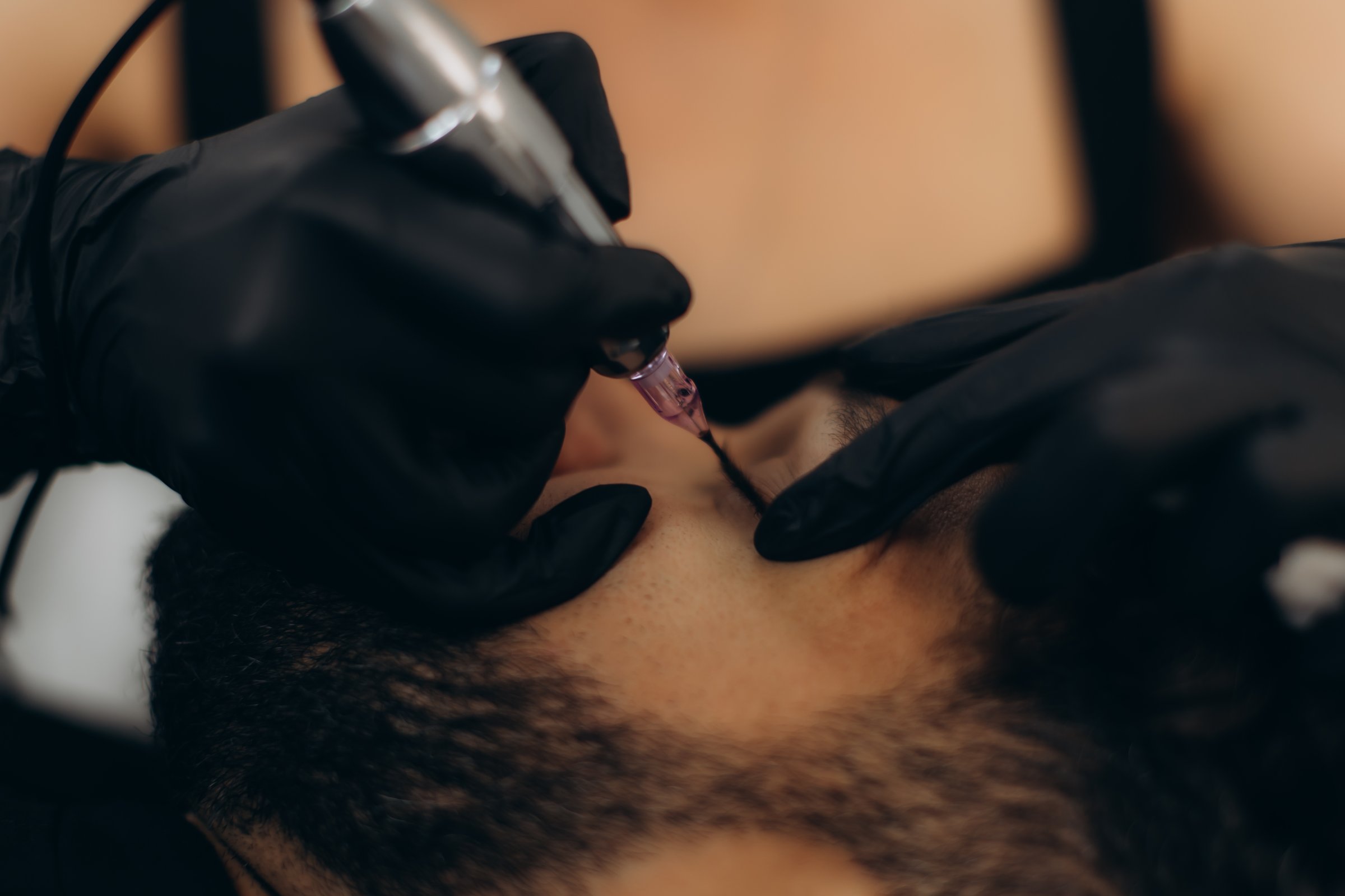 Professional SMP artist applying scalp micropigmentation creating natural hairline in Bradenton FL salon - expert micropigmentation technique for men hair loss solution