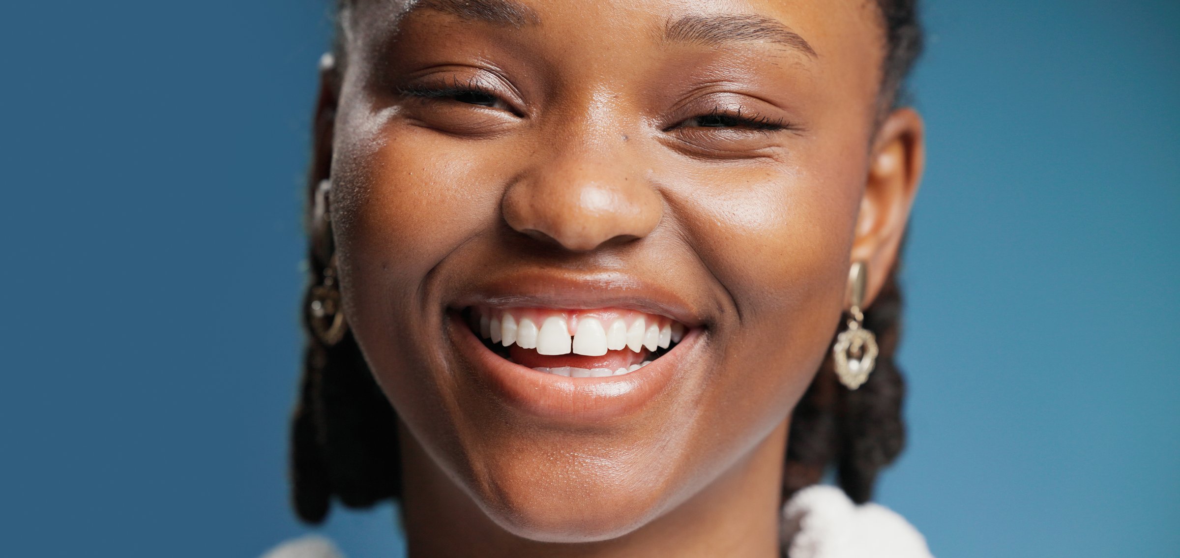 Teeth whitening transformation - Black African woman