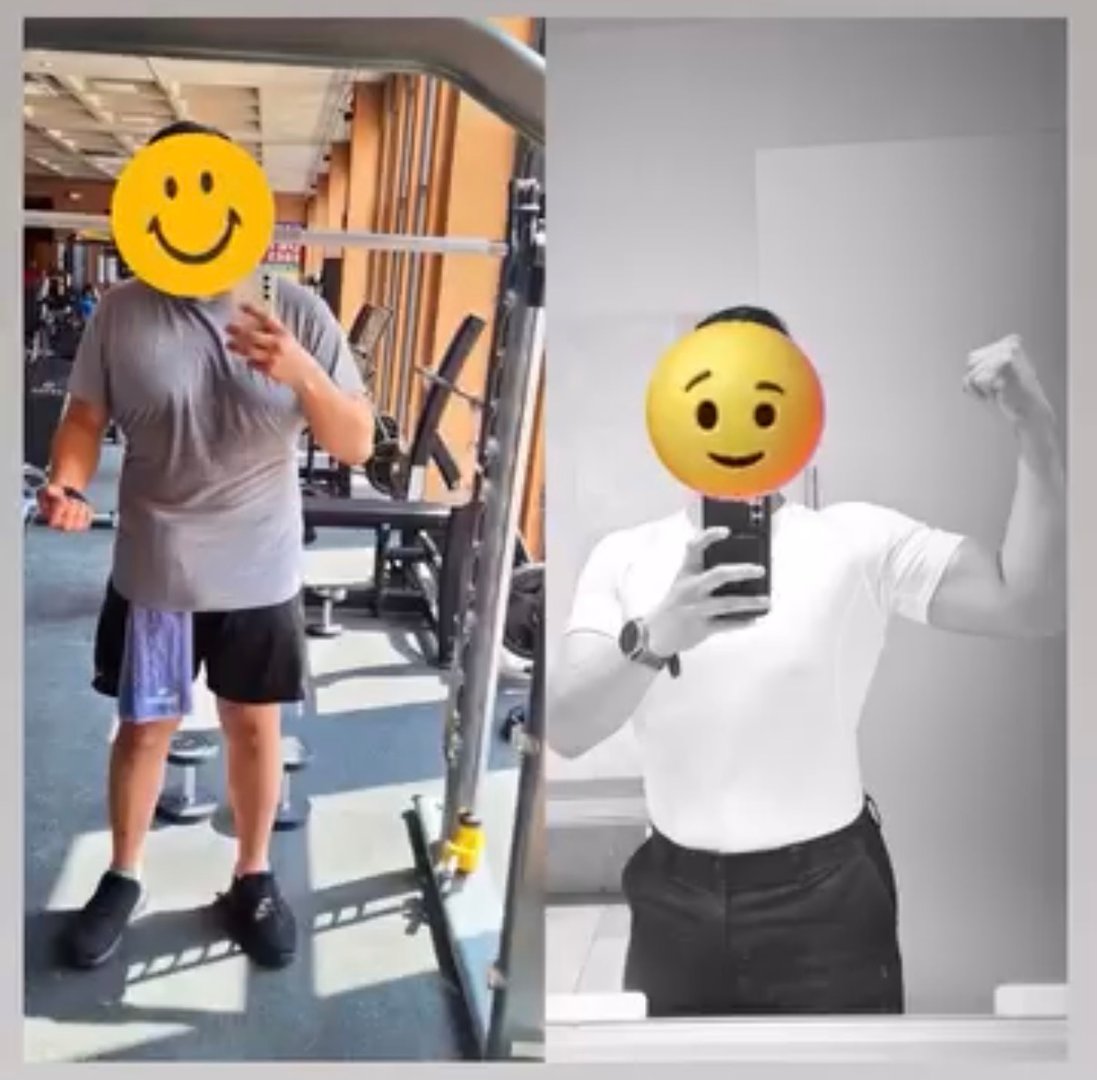 Transformación real de paciente con procedimiento bariátrico - Antes y después