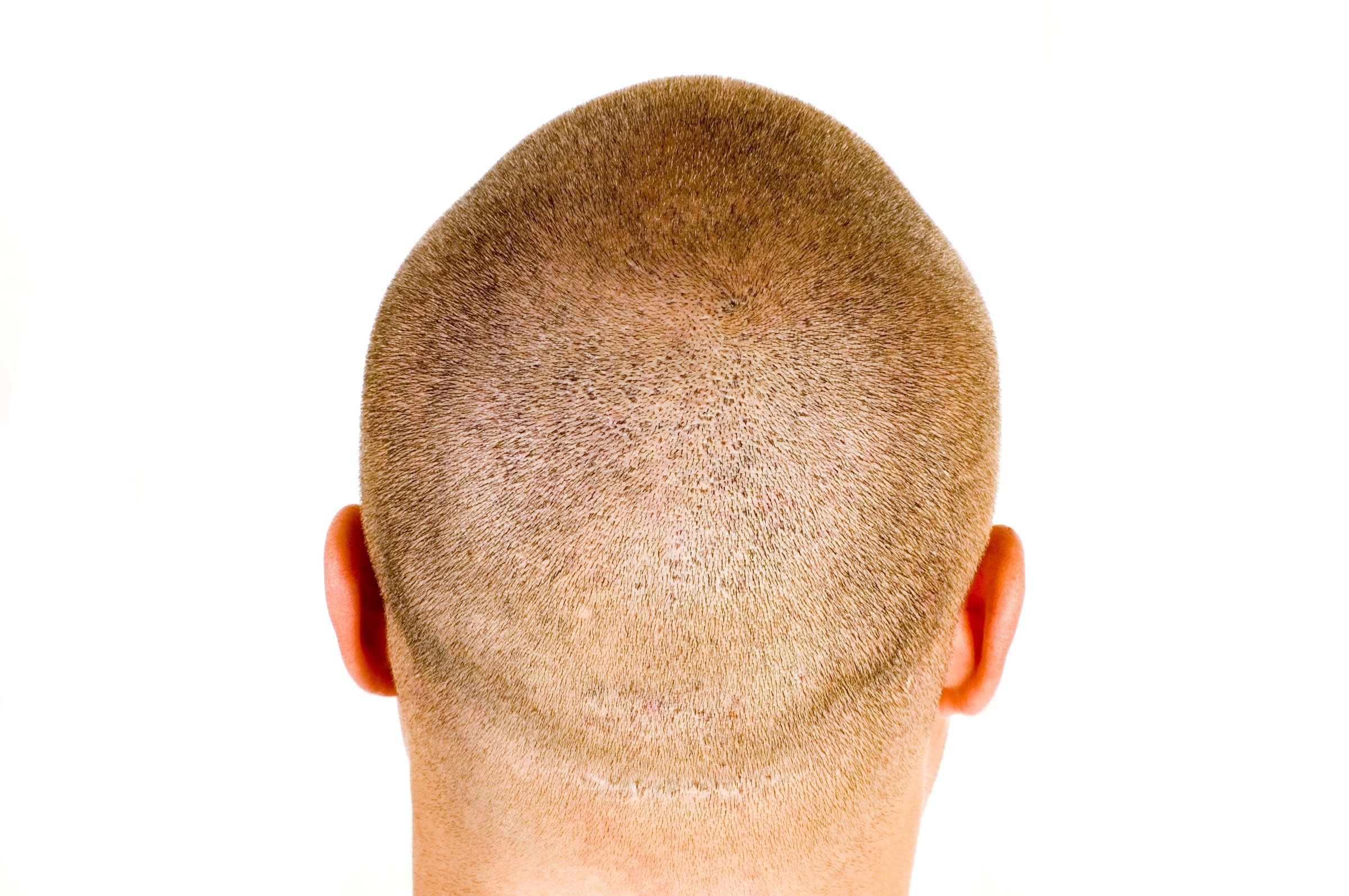 Head of a man with short cutted hair
