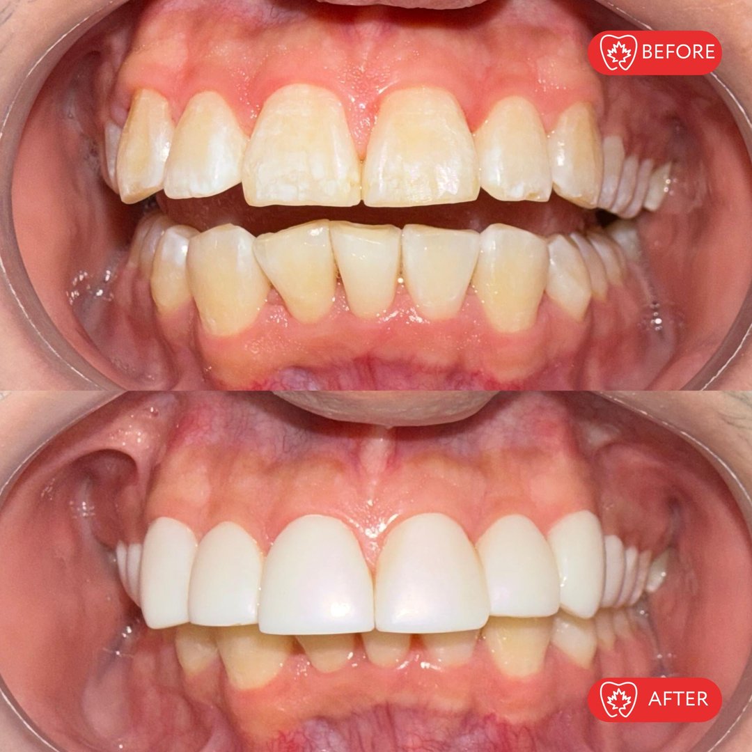 Antes del tratamiento