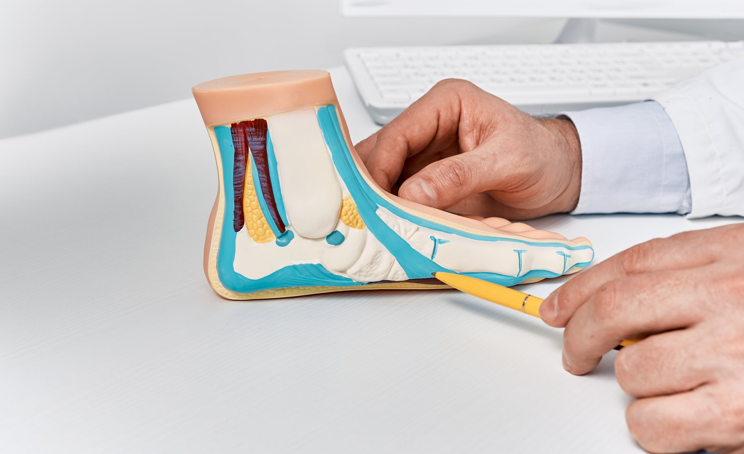 Anatomical flat foot model on doctor table while consultation in orthopedics center. Treatments for flat feet and pes planus