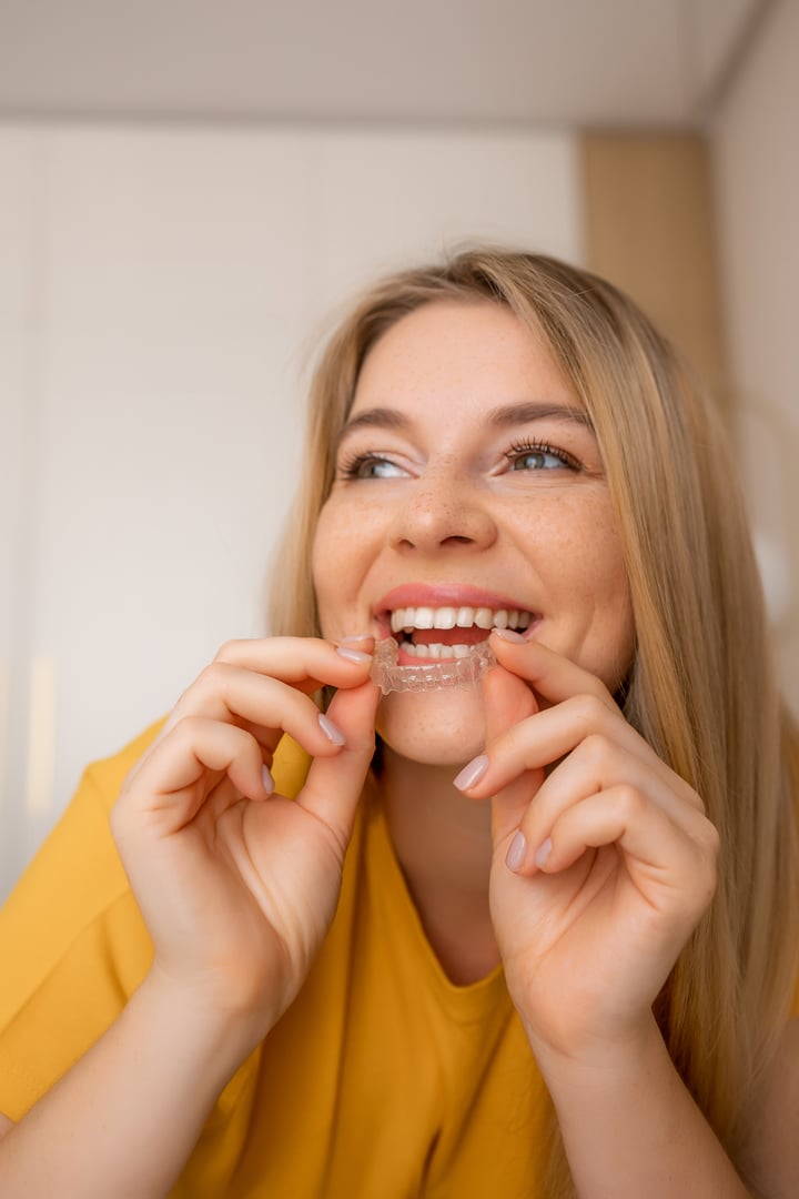 Smiling woman putting on an invisible orthodontic aligner, showing dental care and hygiene.