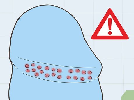 Hình ảnh minh họa hạt ngọc dương vật