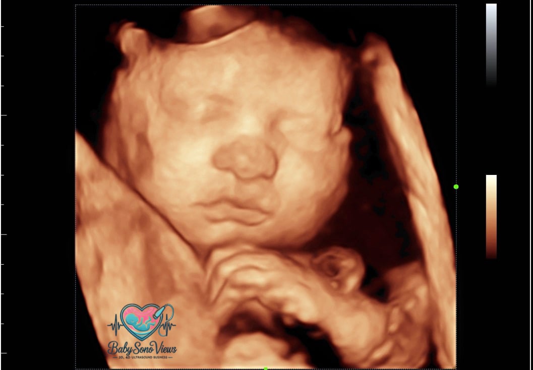 Ultrasound consultation