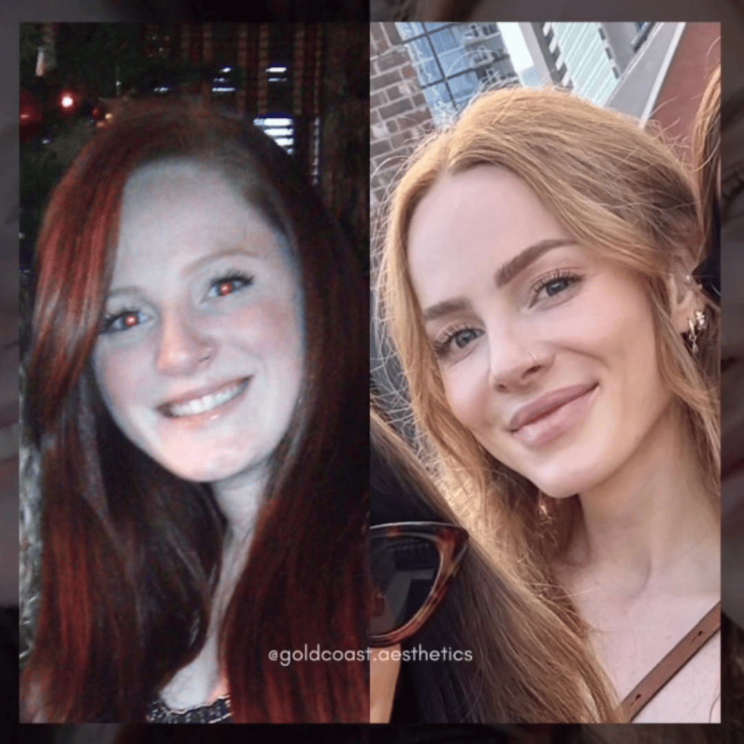 Aesthetic facial transformation