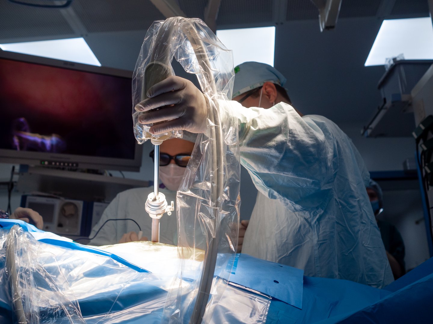 Selective focus on the surgeon's hand inserting an instrument into the patient's body during surgery. Doctors wearing 3D glasses perform laparoscopic surgery using modern high-tech surgical equipment