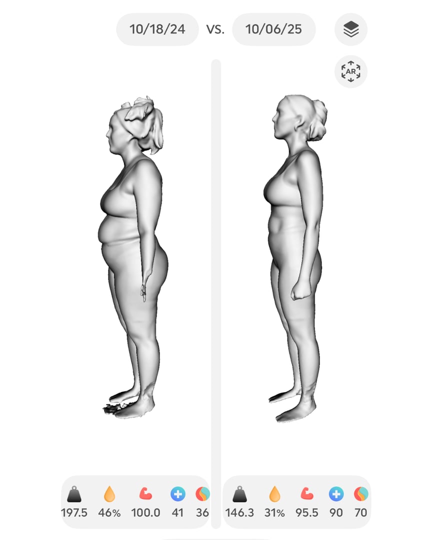 Tirzepatide transformation results