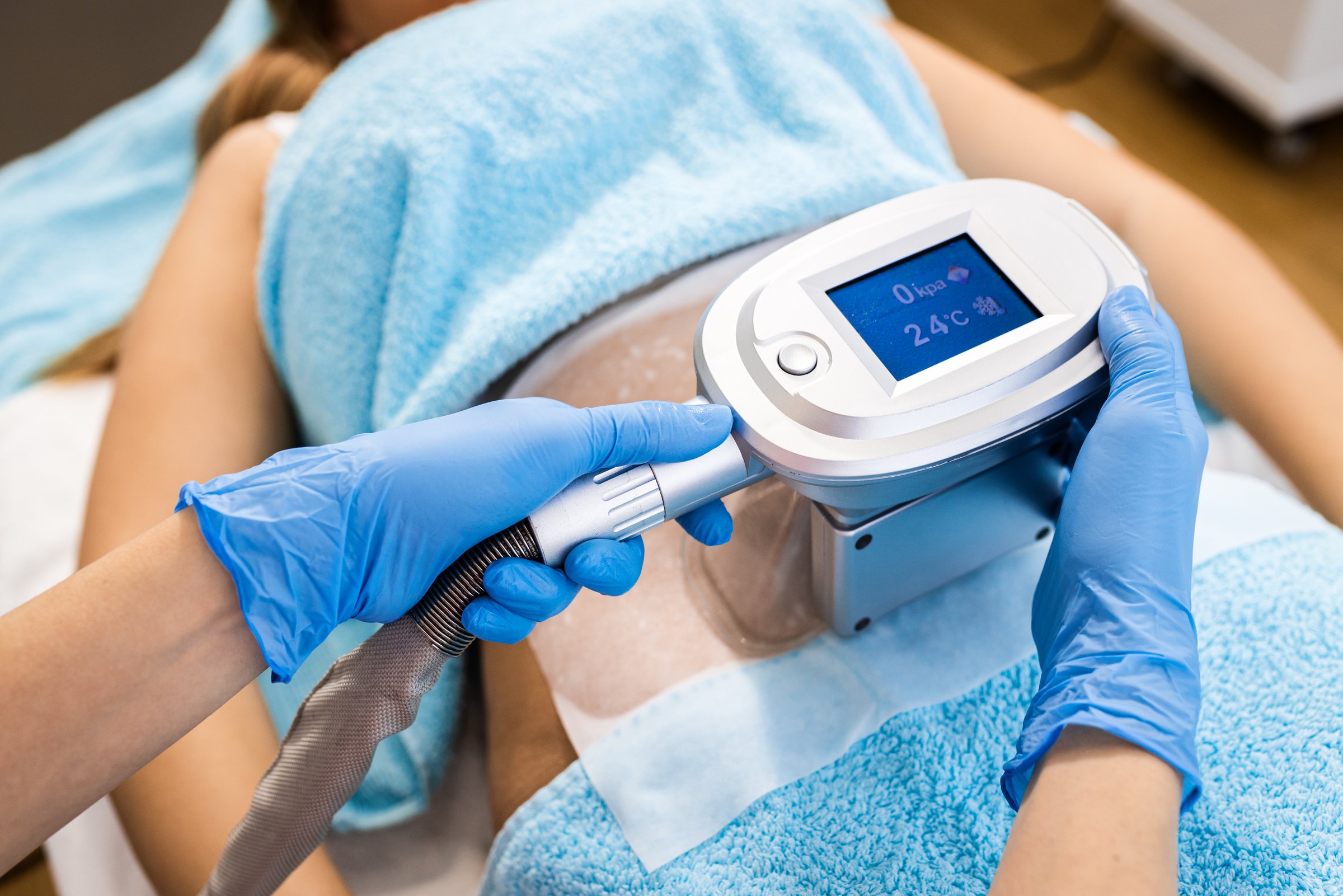 Moderne cryolipolyse behandeling met multi-handle apparaat