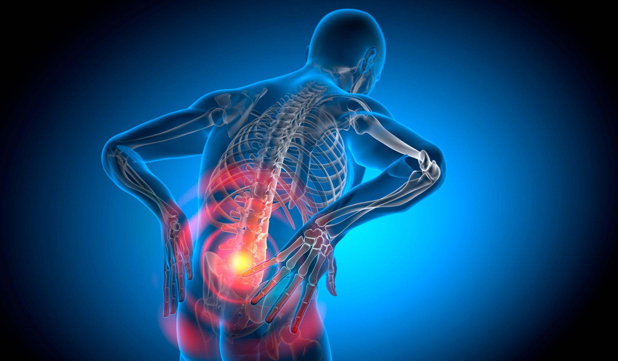 X Ray 3D Rendering - Man with severe pain in the spine and intervertebral discs - Herniated disc