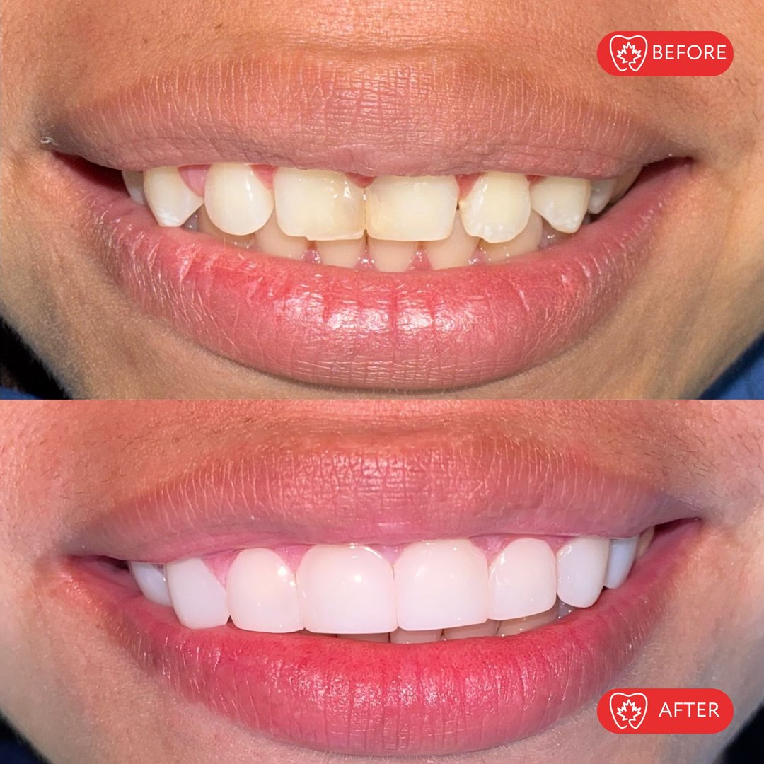 Antes del tratamiento