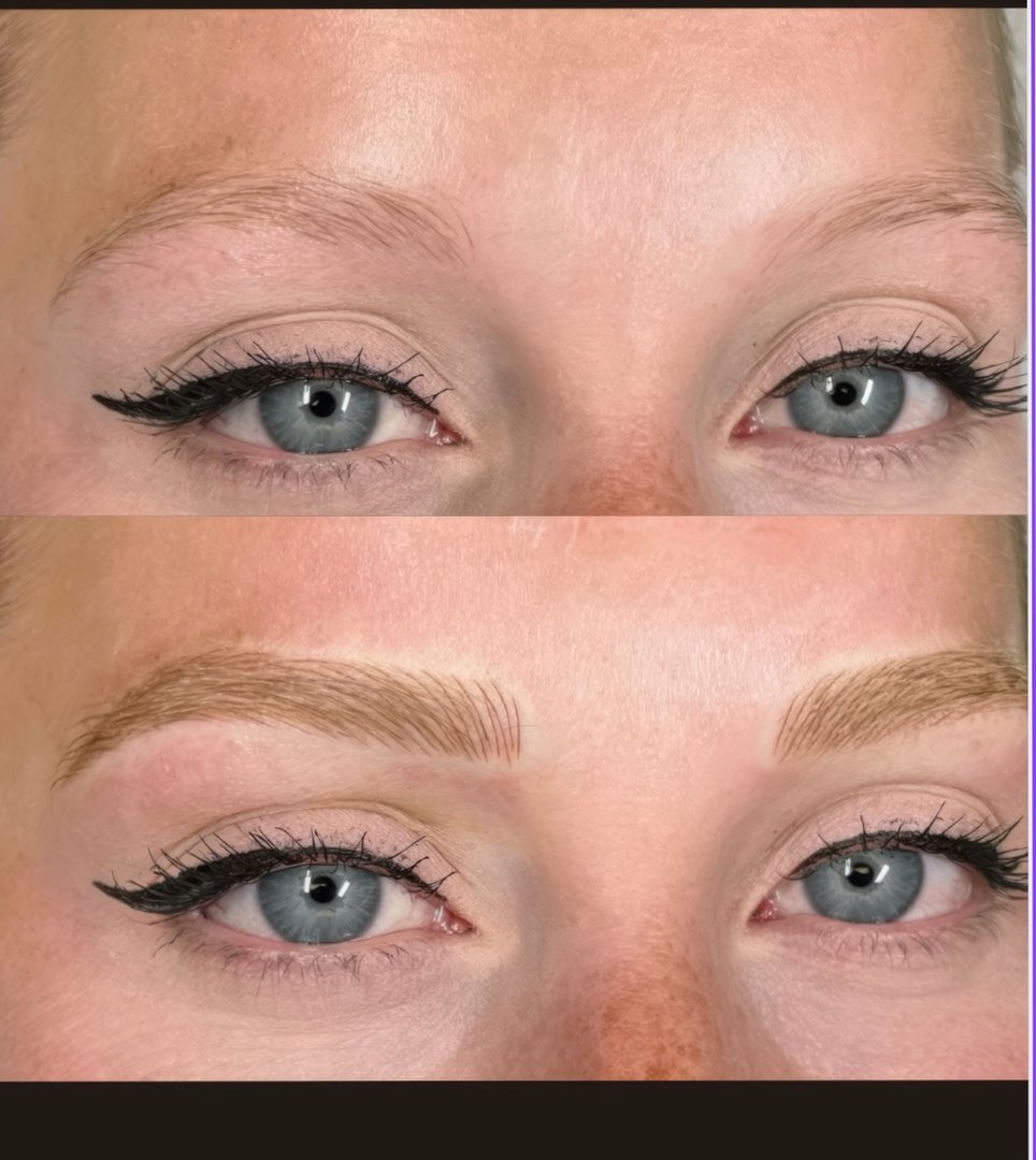 Brow transformation before and after
