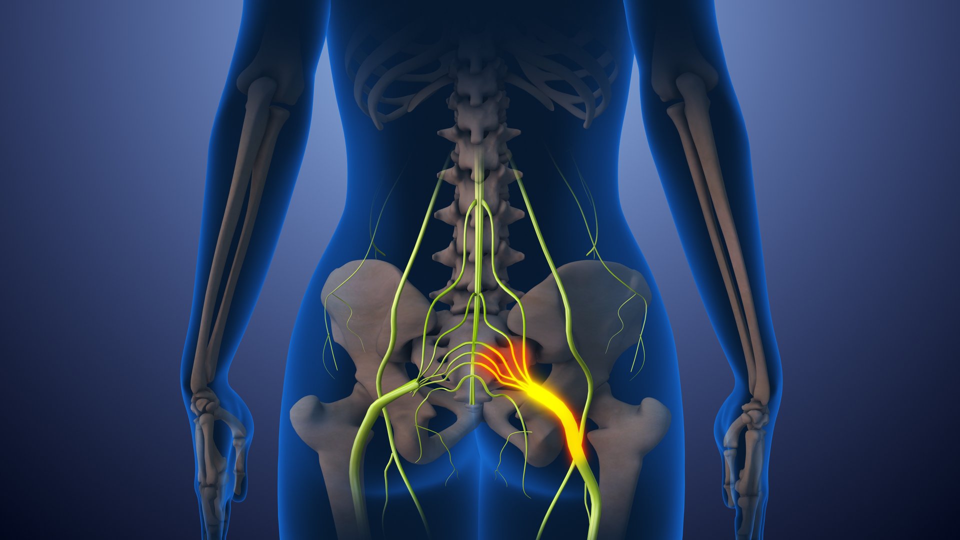 This stock image illustrates sciatica nerve pain, extending from the lower back through the hips to the leg. It highlights the anatomy of the human spine, joints, and nervous system, focusing on inflammation and chronic pain. Emphasizing medical and biological aspects, it details spinal health, injury, and the impact on mobility, showcasing symptoms, diagnosis, and potential treatments.
