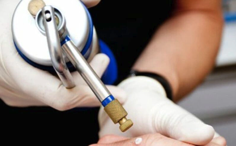 Phương pháp điều trị mụn dương vật