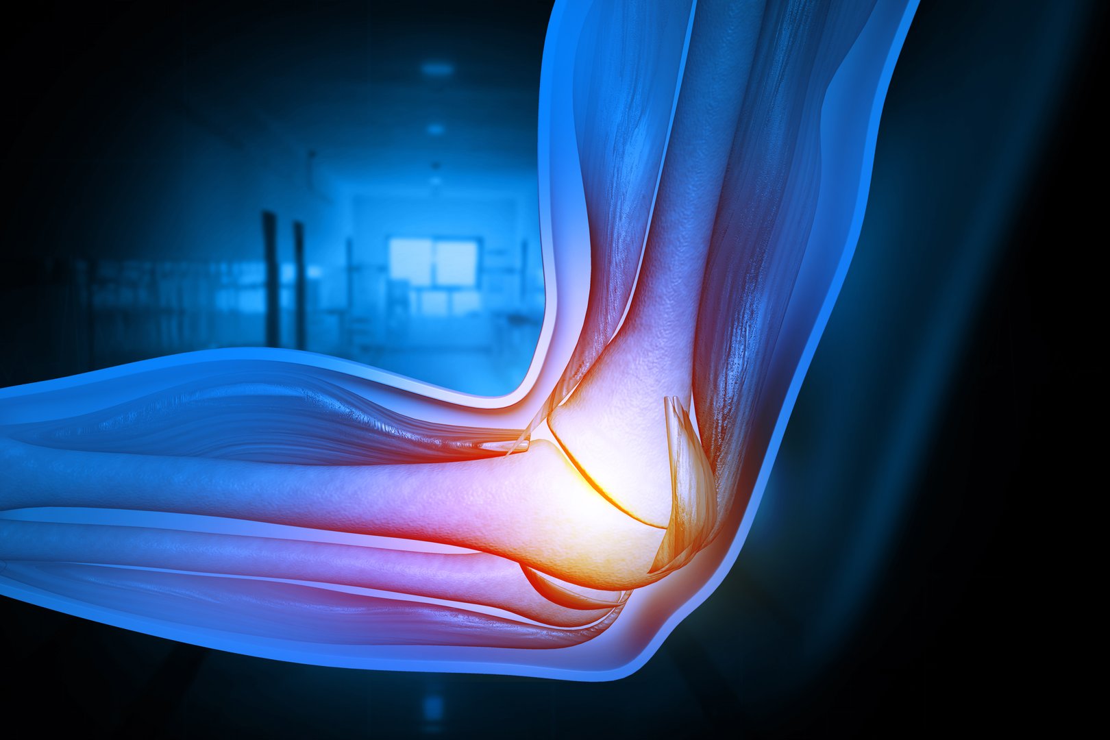 Elbow pain medical illustration showing damaged tendon tissue